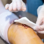 essential steps of wound care